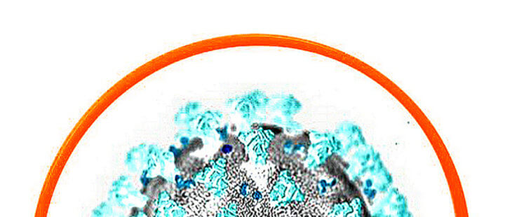 Coronavirus Trascendentale